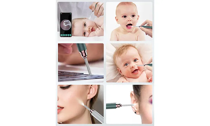 Wireless Endoscope WiFi Medical In Ear Cleaning Spoon